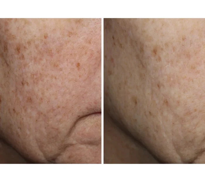 Complexion Brightening Serum